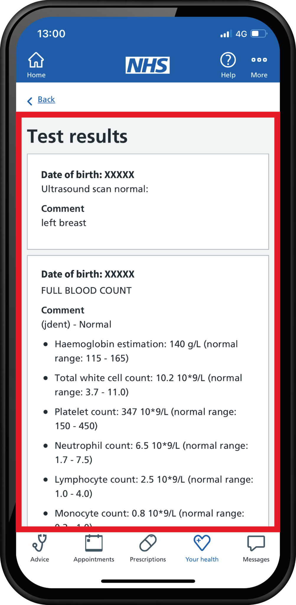 NHS App – How to Check Test Results - Hanley Health Ltd